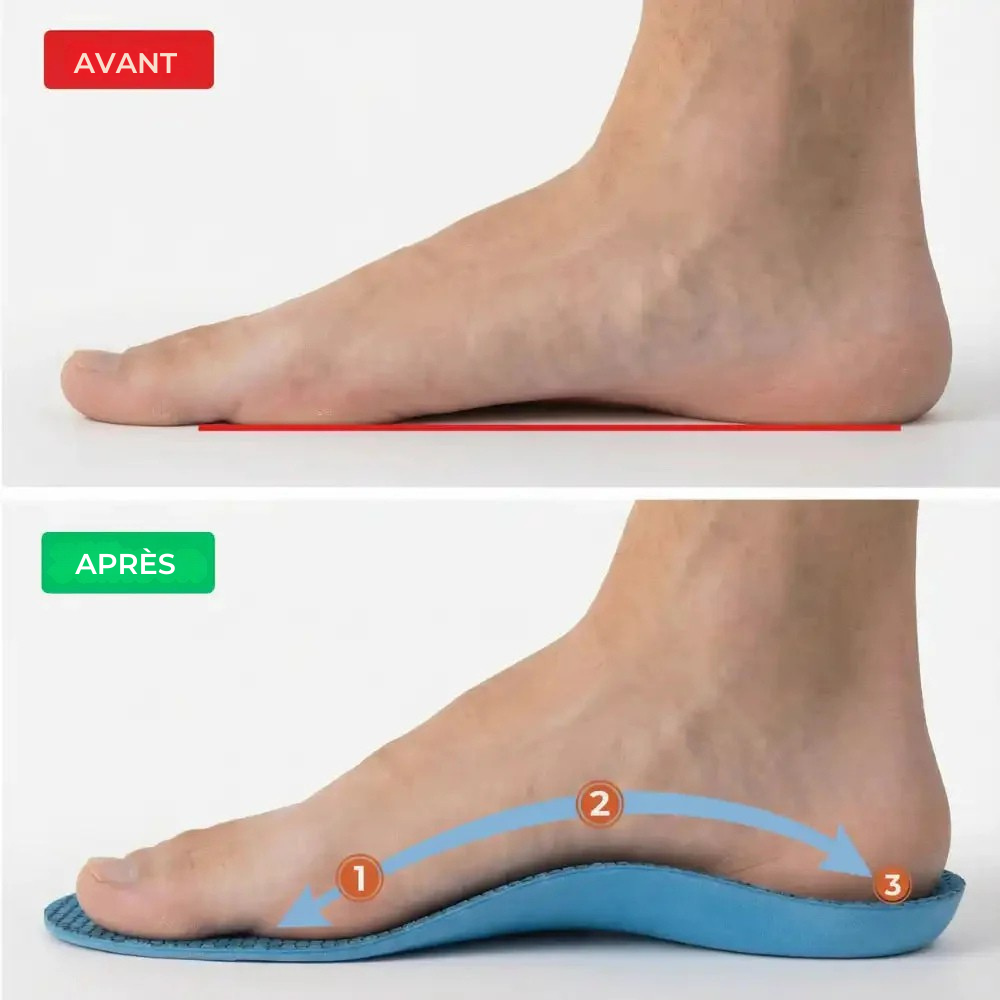 Semelles OrthoStep